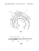 THORACIC INTRODUCER diagram and image