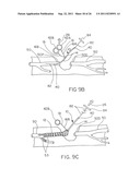 DEVICE FOR RAPID REPAIR OF BODY CONDUITS diagram and image