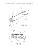 DEVICE FOR RAPID REPAIR OF BODY CONDUITS diagram and image