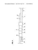 Stent diagram and image