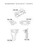 ELBOW RESURFACING PROSTHESIS diagram and image