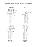 ELBOW RESURFACING PROSTHESIS diagram and image