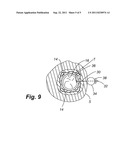 AIRWAY ANCHOR SUTURE TO PREVENT AIRWAY STENT MIGRATION diagram and image