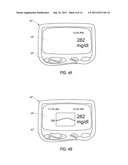 SYSTEM AND METHODS FOR PROCESSING ANALYTE SENSOR DATA diagram and image