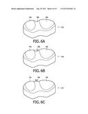 RESPIRATORY INTERFACE WITH FLEXING FACEPLATE diagram and image