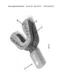 SYSTEMS AND METHODS FOR OPTIMIZING ORAL APPLIANCE THERAPY FOR THE     TREATMENT OF SLEEP APNEA diagram and image