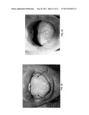 SYSTEMS AND METHODS FOR OPTIMIZING ORAL APPLIANCE THERAPY FOR THE     TREATMENT OF SLEEP APNEA diagram and image