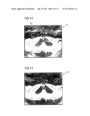 MAGNETIC RESONANCE METHOD AND APPARATUS TO DETERMINE PHASE CORRECTION     PARAMETERS diagram and image