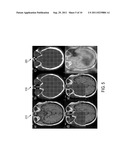 Atlas-Assisted Synthetic Computed Tomography Using Deformable Image     Registration diagram and image