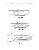 EXPANDABLE IMPELLER PUMP diagram and image