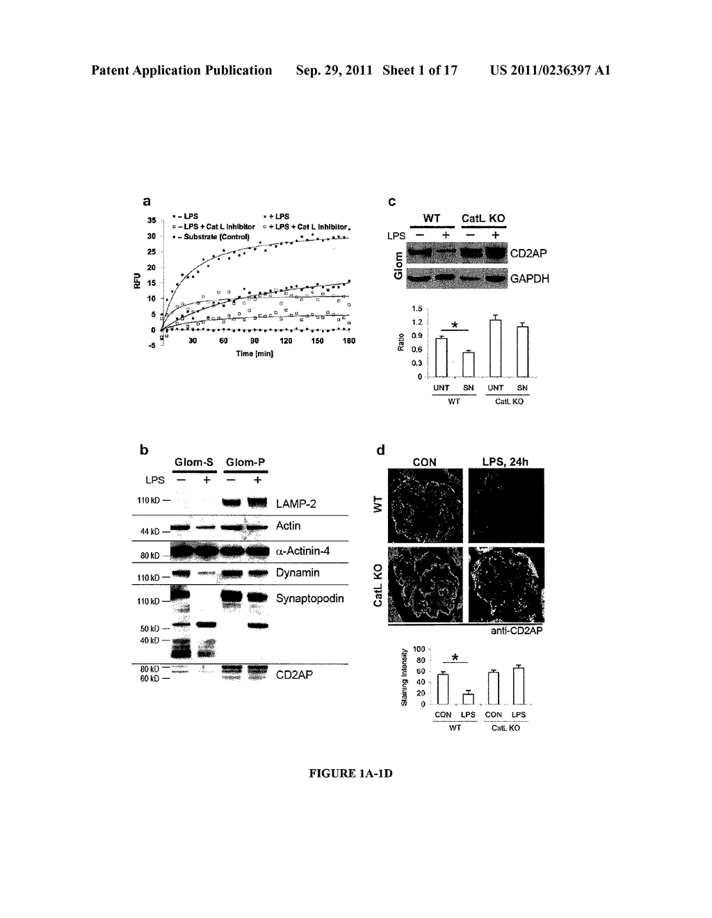 LIMITED PROTEOLYSIS OF CD2AP AND PROGRESSION OF RENAL DISEASE - diagram, schematic, and image 02