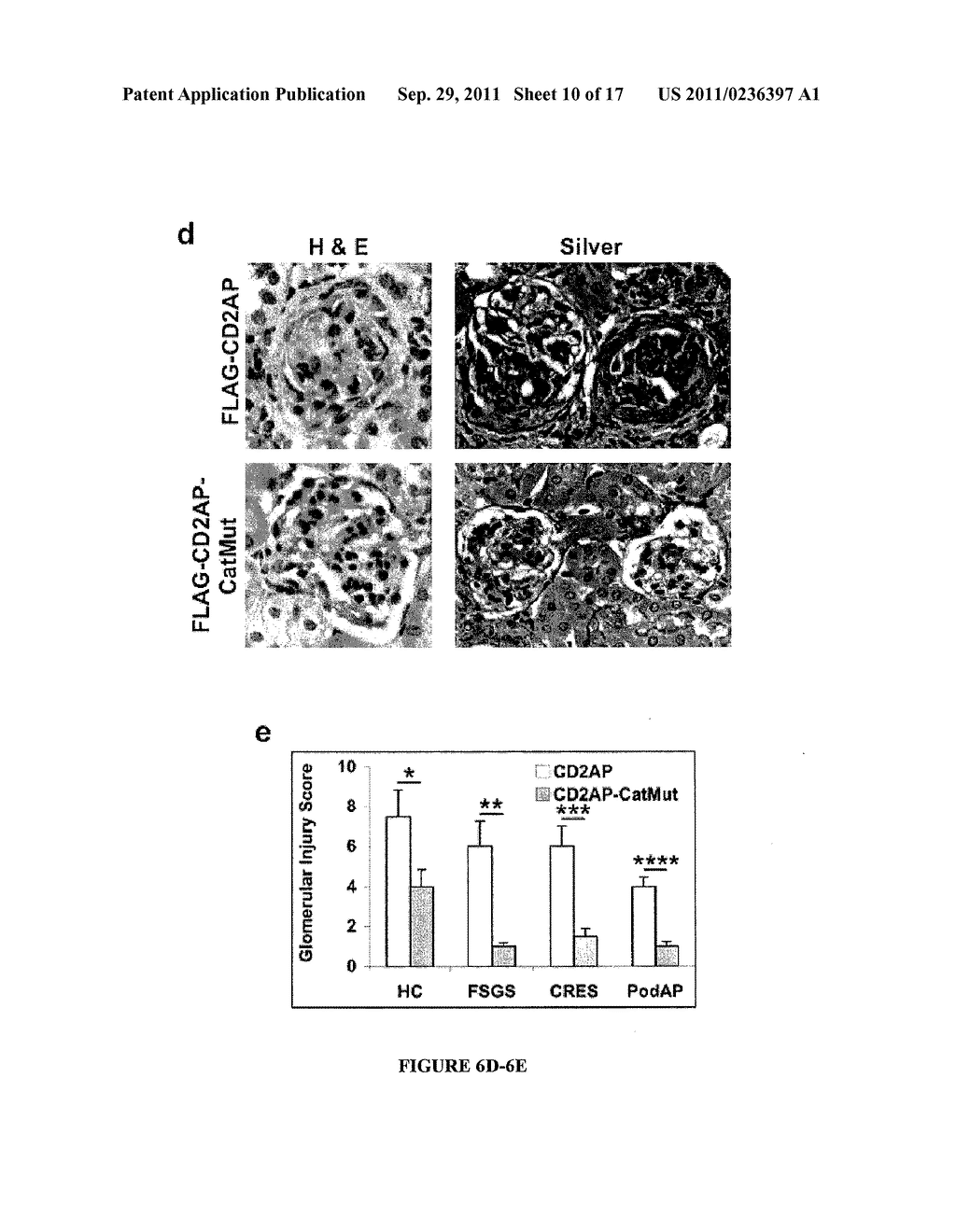 LIMITED PROTEOLYSIS OF CD2AP AND PROGRESSION OF RENAL DISEASE - diagram, schematic, and image 11