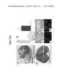 COAGULATION FACTOR MODULATION FOR CONTROLLING TRANSPLANT ORGAN SIZE diagram and image