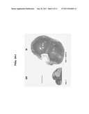 COAGULATION FACTOR MODULATION FOR CONTROLLING TRANSPLANT ORGAN SIZE diagram and image