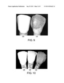 SOLID ORAL SENSORIAL PRODUCTS INCLUDING STAIN INHIBITOR diagram and image