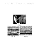 MEMBRANE diagram and image