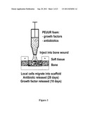 INJECTABLE DUAL DELIVERY ALLOGRAPH BONE/POLYMER COMPOSITE FOR TREATMENT OF     OPEN FRACTURES diagram and image