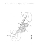 Dental device, such as bridge or insert diagram and image