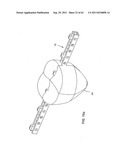 Dental device, such as bridge or insert diagram and image