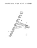 Dental device, such as bridge or insert diagram and image