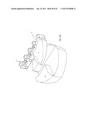 Dental device, such as bridge or insert diagram and image