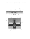 Dental device, such as bridge or insert diagram and image