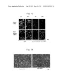 INHIBITORY RNA FOR MODULATING THE MOLECULAR FUNCTION OF ZFAT GENE diagram and image