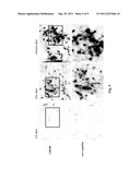 HYDROXYBUTYRATE ESTER AND MEDICAL USE THEREOF diagram and image