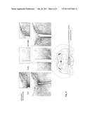 HYDROXYBUTYRATE ESTER AND MEDICAL USE THEREOF diagram and image