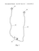 PELVIC IMPLANT WITH SELECTIVE LOCKING ANCHOR diagram and image