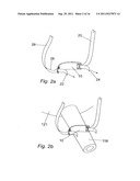 PELVIC IMPLANT WITH SELECTIVE LOCKING ANCHOR diagram and image