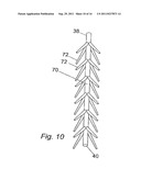 PELVIC IMPLANT WITH SELECTIVE LOCKING ANCHOR diagram and image