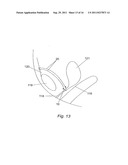 PELVIC IMPLANT WITH SELECTIVE LOCKING ANCHOR diagram and image