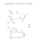 PELVIC IMPLANT WITH SELECTIVE LOCKING ANCHOR diagram and image