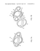 PELVIC IMPLANT WITH SUSPENDING SYSTEM diagram and image