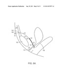 PELVIC IMPLANT WITH SUSPENDING SYSTEM diagram and image