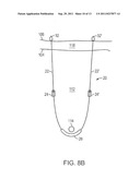 PELVIC IMPLANT WITH SUSPENDING SYSTEM diagram and image