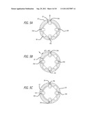 Endoscope Structures And Techniques For Navigating To A Target In Branched     Structure diagram and image