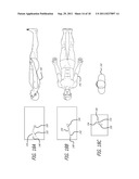 Endoscope Structures And Techniques For Navigating To A Target In Branched     Structure diagram and image