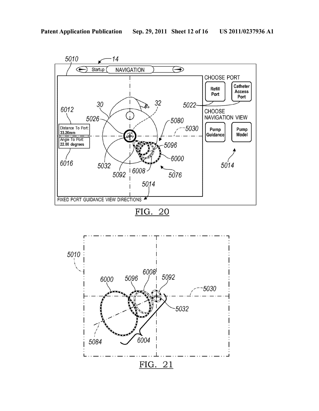 Method and Apparatus for Guiding an External Needle to an Implantable     Device - diagram, schematic, and image 13