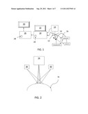 METHODS AND APPARATUS FOR ULTRASOUND STRAIN IMAGING diagram and image