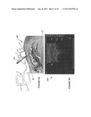 PERCUTANEOUS NEEDLE GUIDE AND METHODS OF USE diagram and image