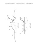 NEURAL MONITORING SYSTEM diagram and image