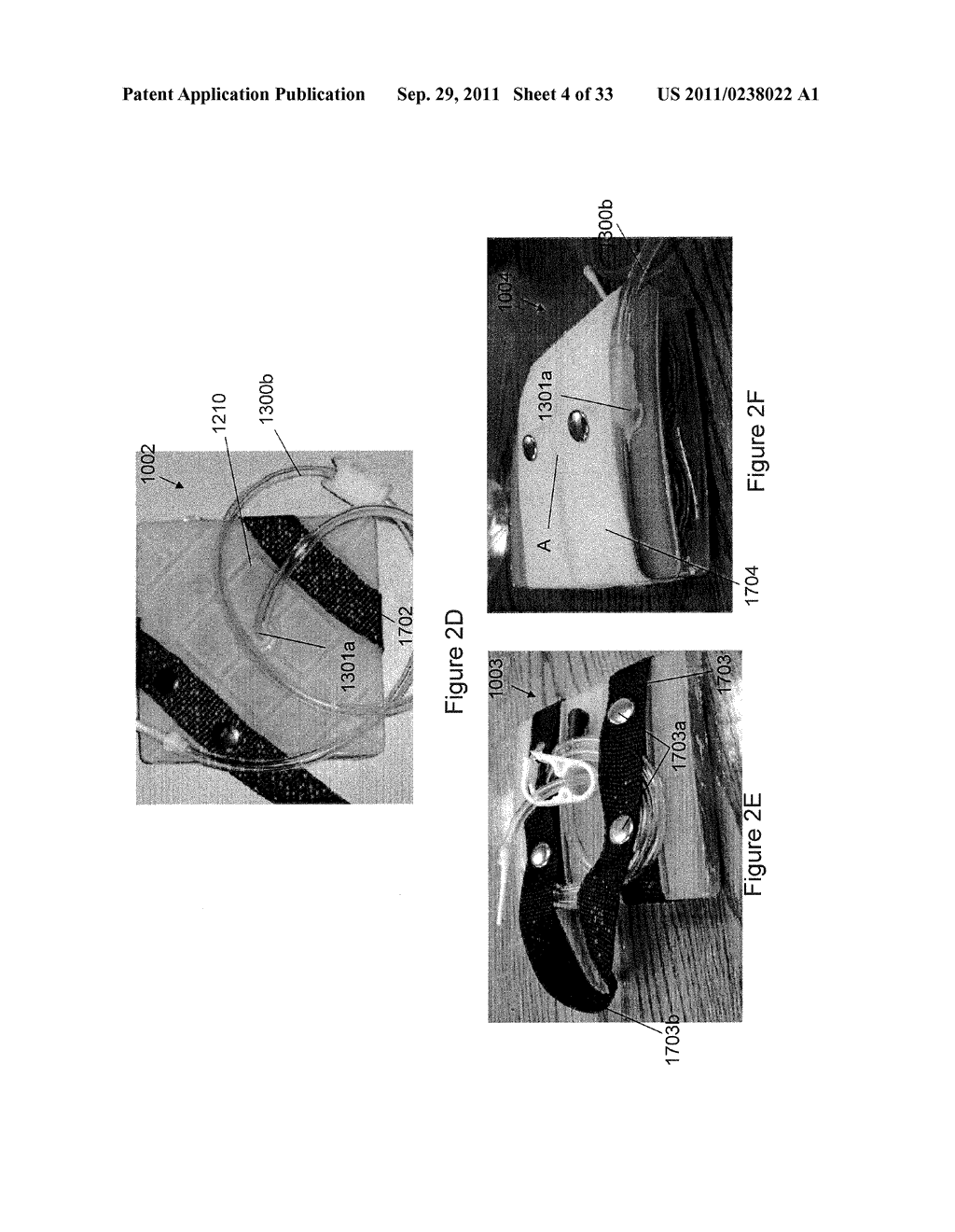 CORPOREAL DRAINAGE SYSTEM - diagram, schematic, and image 05