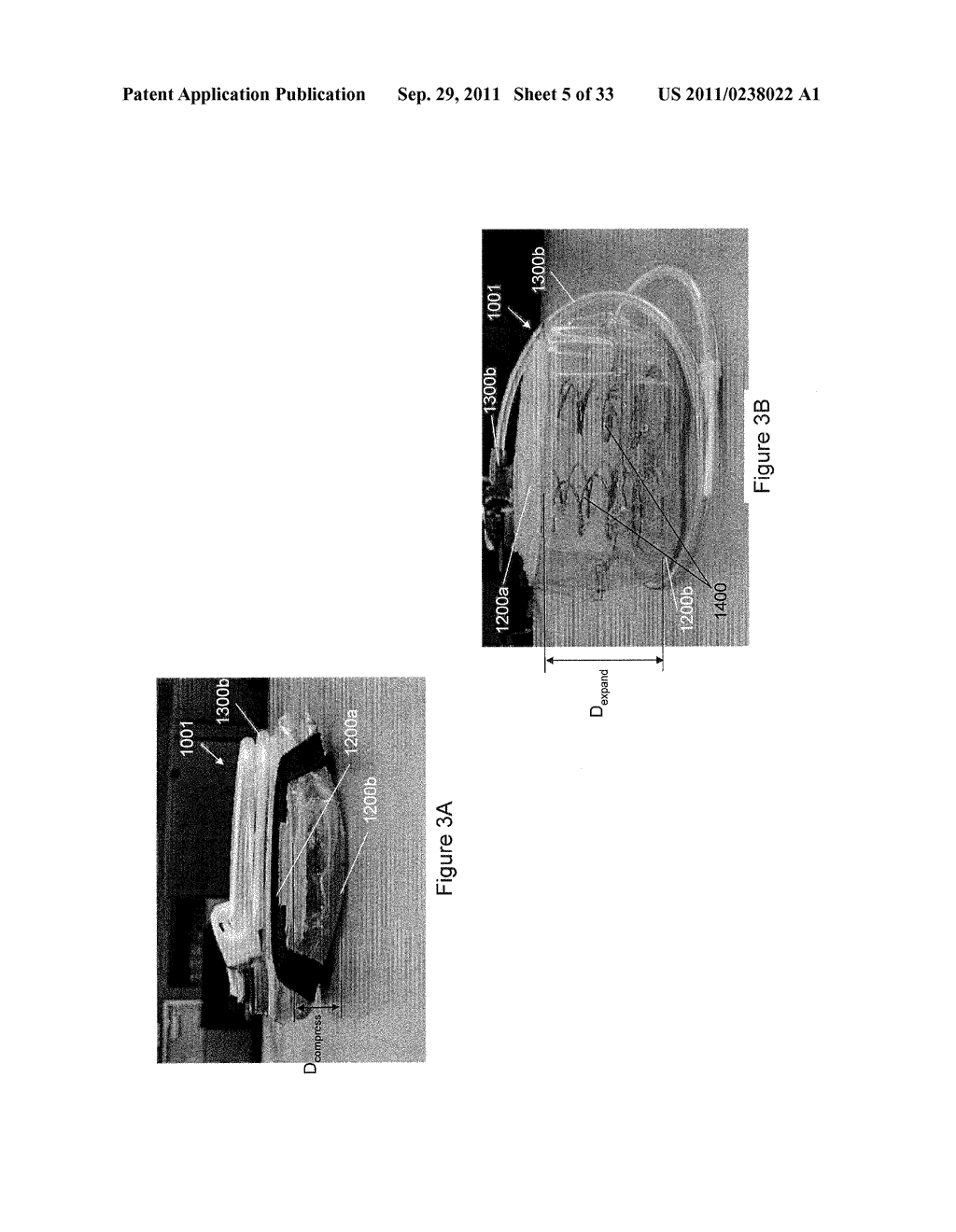 CORPOREAL DRAINAGE SYSTEM - diagram, schematic, and image 06