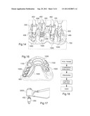 DRILL ASSISTANCE KIT FOR IMPLANT HOLE IN A BONE STRUCTURE diagram and image