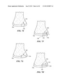 Patient Selectable Joint Arthroplasty Devices and Surgical Tools diagram and image