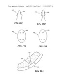 Patient Selectable Joint Arthroplasty Devices and Surgical Tools diagram and image