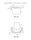 Patient Selectable Joint Arthroplasty Devices and Surgical Tools diagram and image