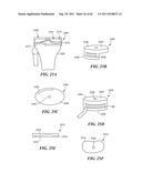 Patient Selectable Joint Arthroplasty Devices and Surgical Tools diagram and image